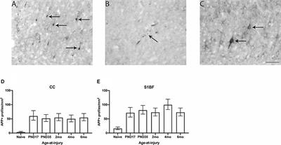 Age-at-Injury Determines the Extent of Long-Term Neuropathology and Microgliosis After a Diffuse Brain Injury in Male Rats